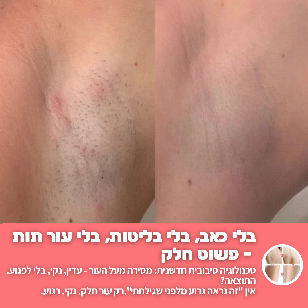 מסיר שיער לגוף חשמלי מבית breathy- בית שחי וביקיני • ללא קוצים • עמיד במים