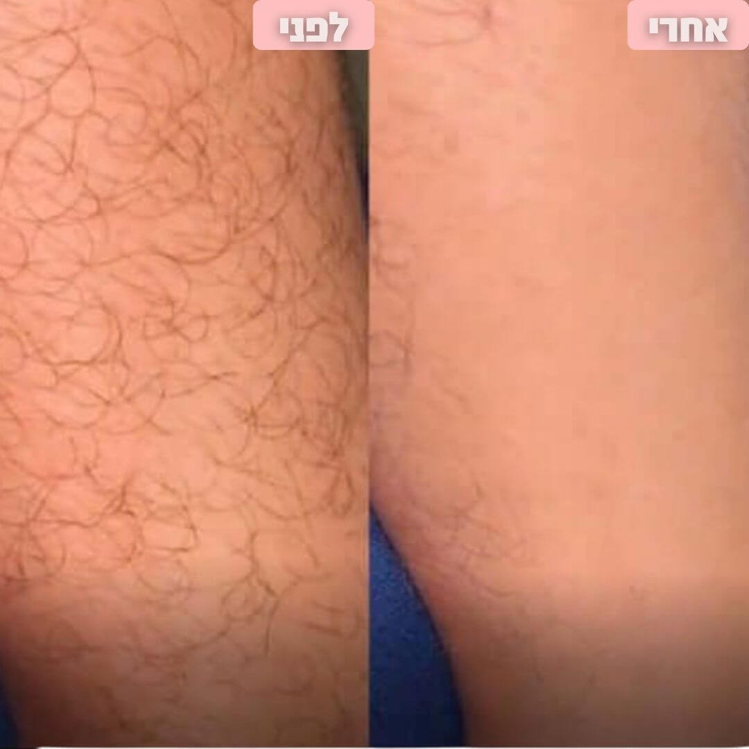 תמונות (6) (1).jpg__PID:a8f38731-3221-4b4b-befb-da2b11f5ce1d