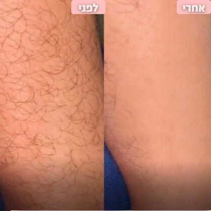 מסיר שיער לגוף חשמלי מבית breathy- בית שחי וביקיני • ללא קוצים • עמיד במים