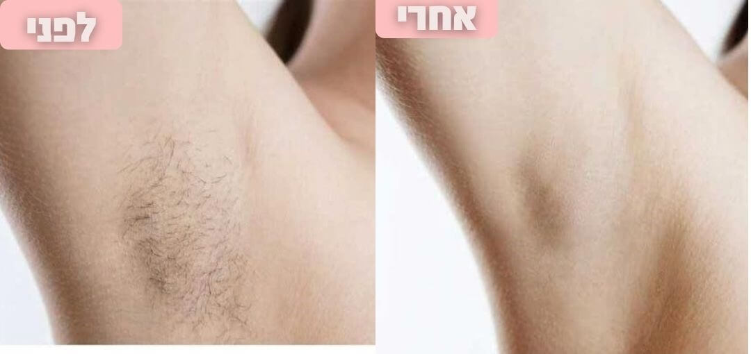 תמונות (7) (1).jpg__PID:69a8f387-3132-415b-8bfe-fbda2b11f5ce