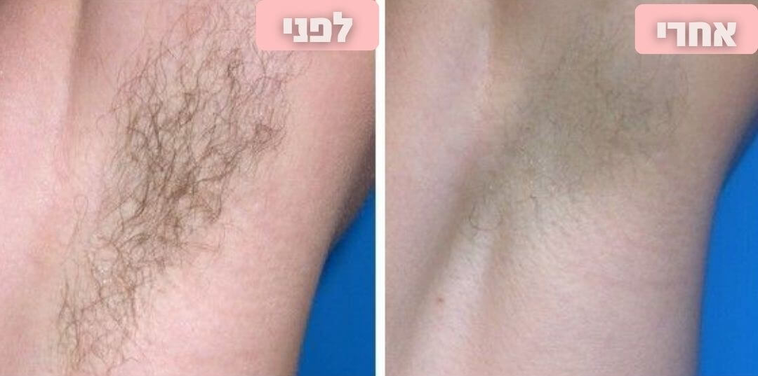 תמונות (8) (1).jpg__PID:6869a8f3-8731-4221-9b4b-fefbda2b11f5