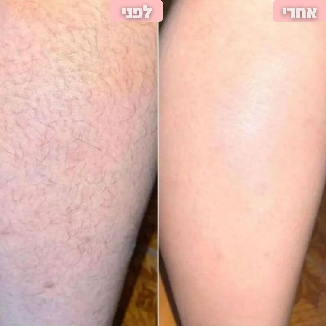 מסיר שיער לגוף חשמלי מבית breathy- בית שחי וביקיני • ללא קוצים • עמיד במים